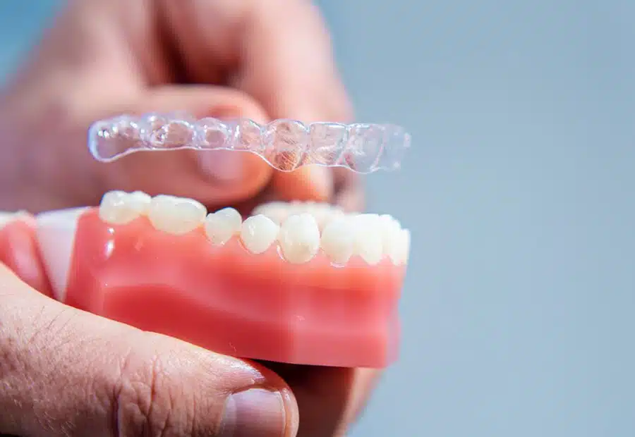 invisalign